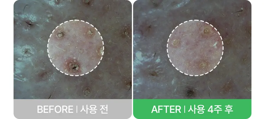 포어 펩타이드 피지 멜팅 크림 투 오일 50ml Detail