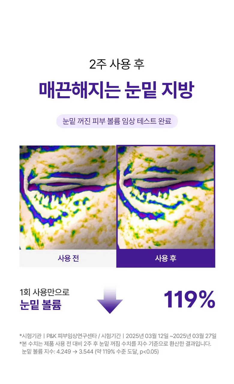 메라블 유쎄라블 리프팅샷 900 눈밑 지방 볼륨 주름개선 안티에이징 아이크림, 15ml, 1개 Detail