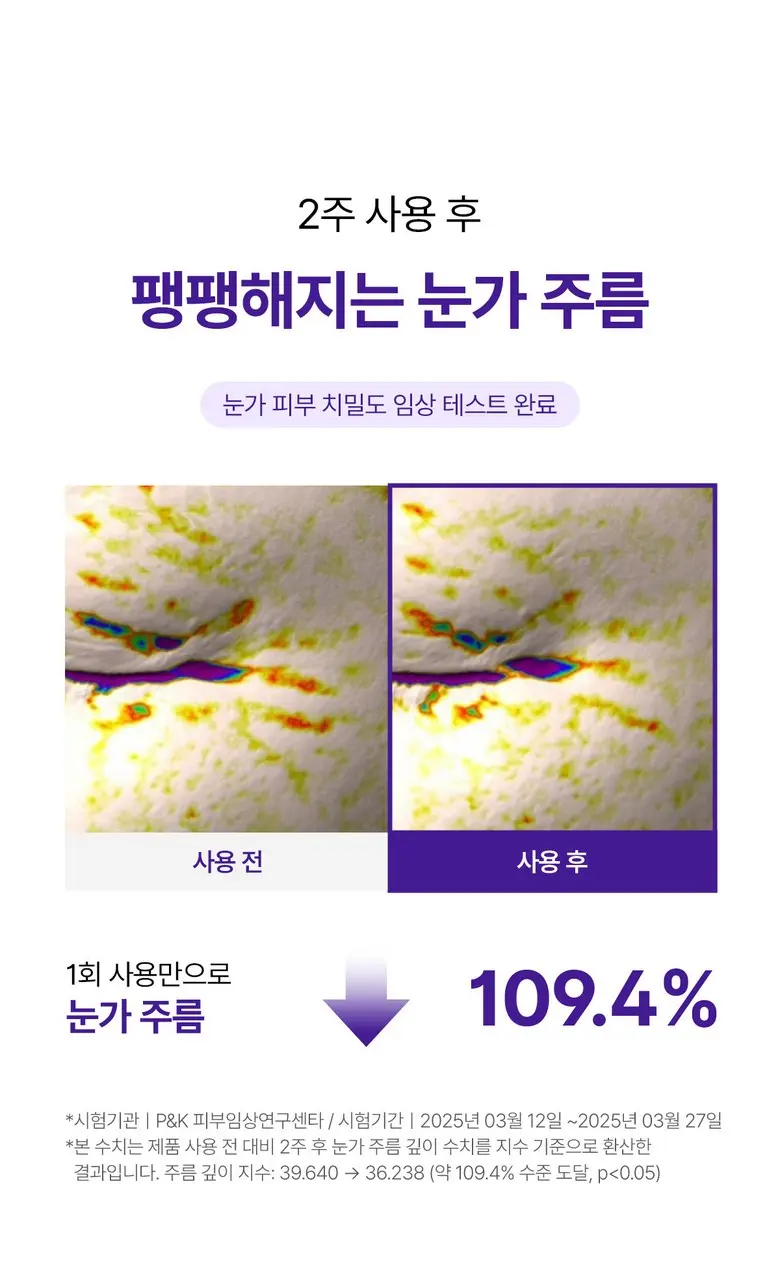 메라블 유쎄라블 리프팅샷 900 눈밑 지방 볼륨 주름개선 안티에이징 아이크림, 15ml, 1개 Detail