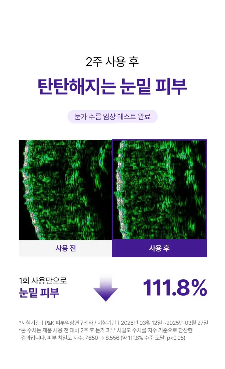 메라블 유쎄라블 리프팅샷 900 눈밑 지방 볼륨 주름개선 안티에이징 아이크림, 15ml, 1개 Detail