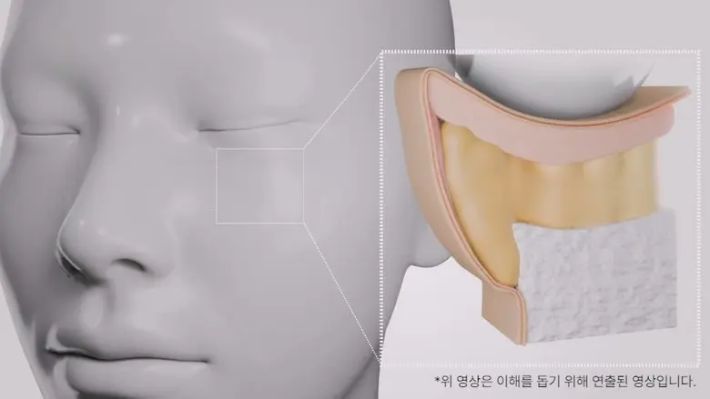 메라블 유쎄라블 리프팅샷 900 눈밑 지방 볼륨 주름개선 안티에이징 아이크림, 15ml, 1개 Detail
