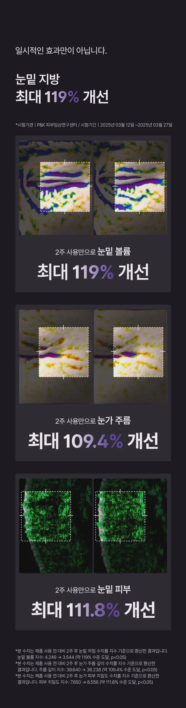 메라블 유쎄라블 리프팅샷 900 눈밑 지방 볼륨 주름개선 안티에이징 아이크림, 15ml, 1개 Detail