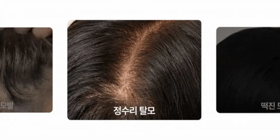 ASHROLEN Beer Yeast Vital Scalp Ampoule 100ml Detail