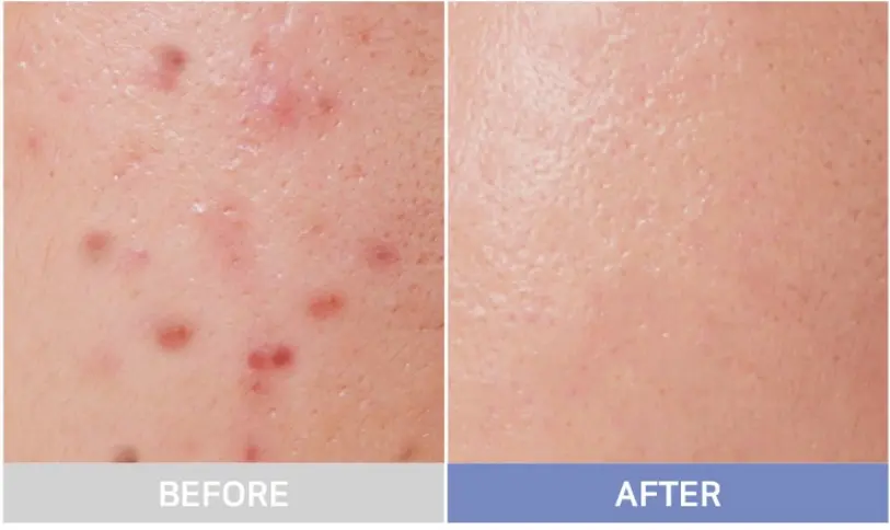 OOTD Intensive Face Serum 50g