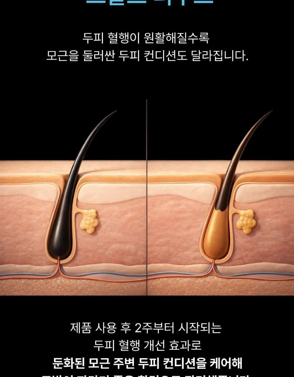 [리뷰이벤트] 네쉬 PDRN 스피큘 샷 스칼프 세럼 50ml | 올리브영 Detail