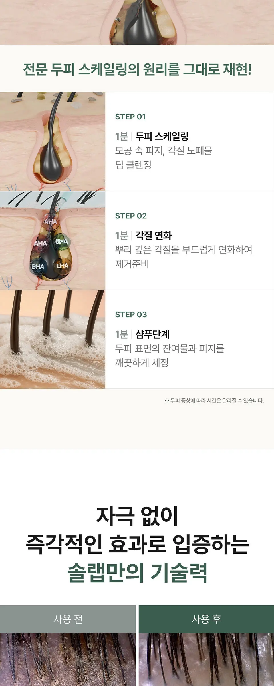 헤어루트 아쿠아픽 두피 스케일러 Detail