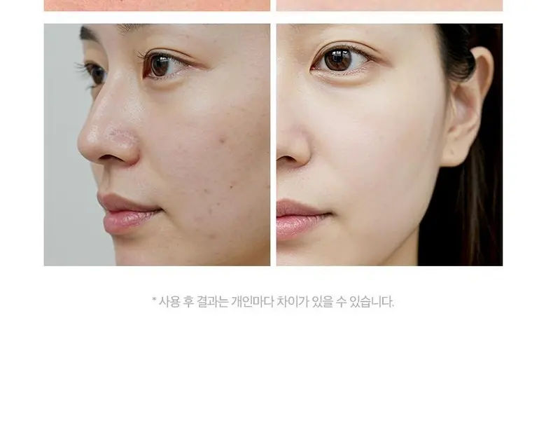 메디율 율무팩 미백 워시오프팩 모공 피지 기미 피지흡착 모공축소 피지제거 진정 수분 곡물 팩, 1개, 1개입 Detail