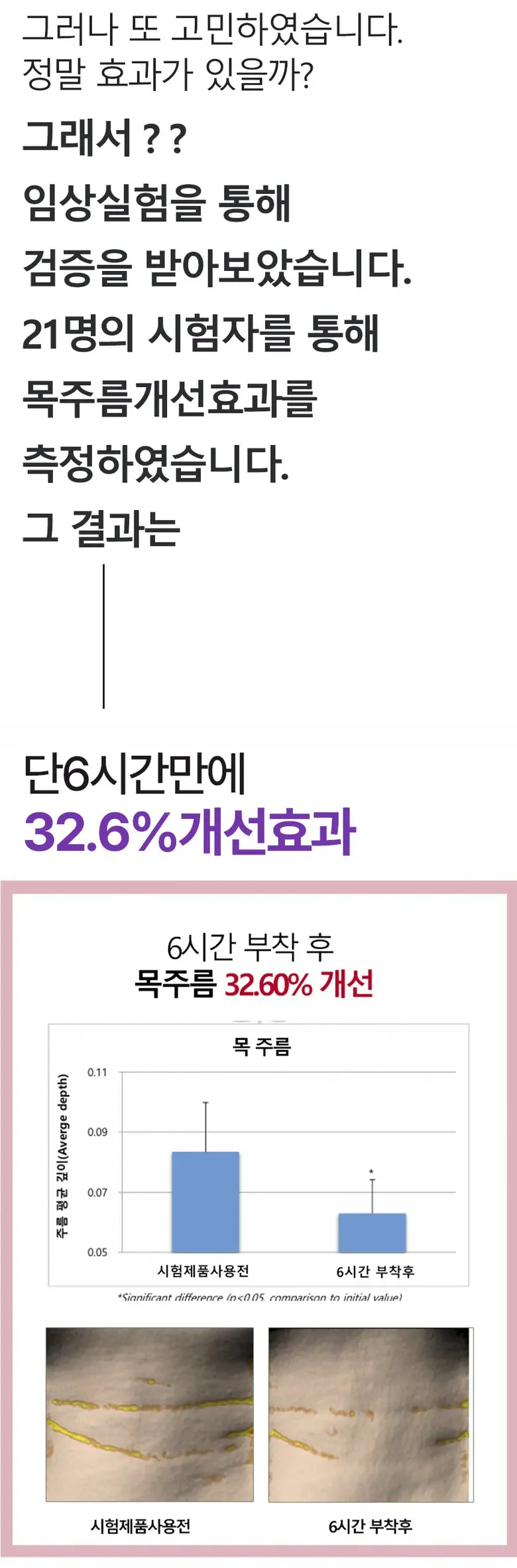 로로스키니 콜라겐 목 마스크팩 주름 하이드로겔 넥 젤리 패치 30매 + 젤 리프팅 보습 목주름 밴드, 1개, 30개입 Detail