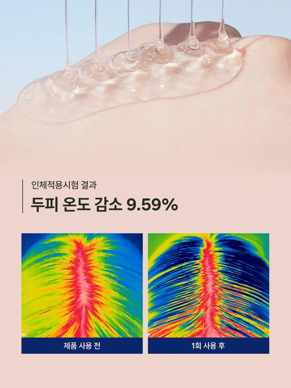 [청량 두피 케어] 다노날 창포 바이 엑소좀 스칼프 세럼 130ml | 올리브영 Detail