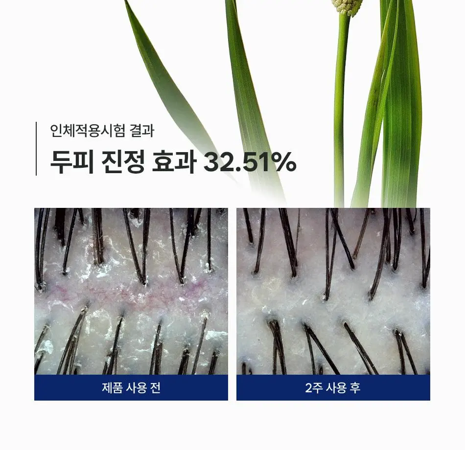 [청량 두피 케어] 다노날 창포 바이 엑소좀 스칼프 세럼 130ml | 올리브영 Detail