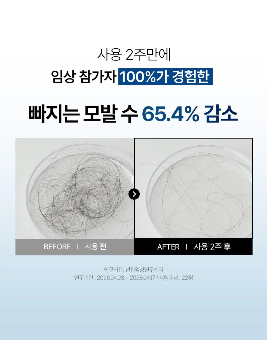 [대용량 탈모토닉] 에이페 블루 펩타이드 스칼프 토닉 200ml | 올리브영 Detail