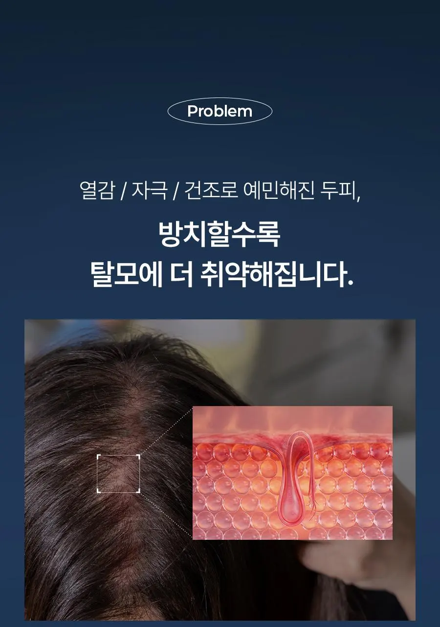 [대용량 탈모토닉] 에이페 블루 펩타이드 스칼프 토닉 200ml | 올리브영 Detail