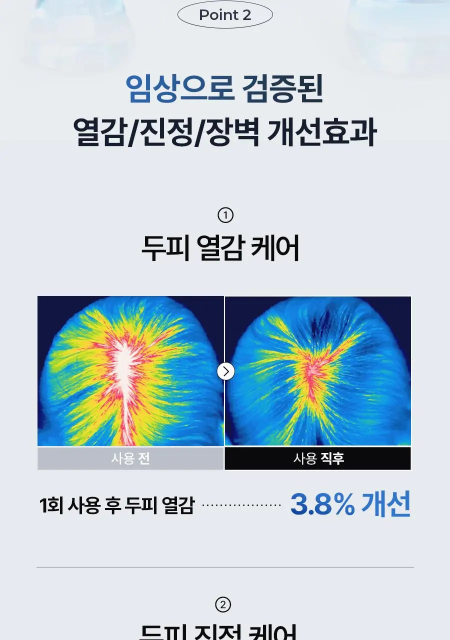 [대용량 탈모토닉] 에이페 블루 펩타이드 스칼프 토닉 200ml | 올리브영 Detail