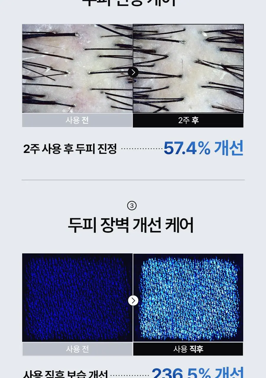 [대용량 탈모토닉] 에이페 블루 펩타이드 스칼프 토닉 200ml | 올리브영 Detail