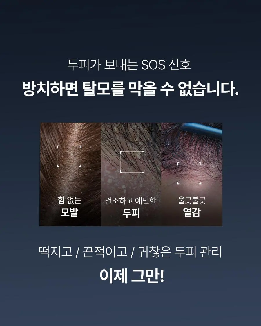 [대용량 탈모토닉] 에이페 블루 펩타이드 스칼프 토닉 200ml | 올리브영 Detail