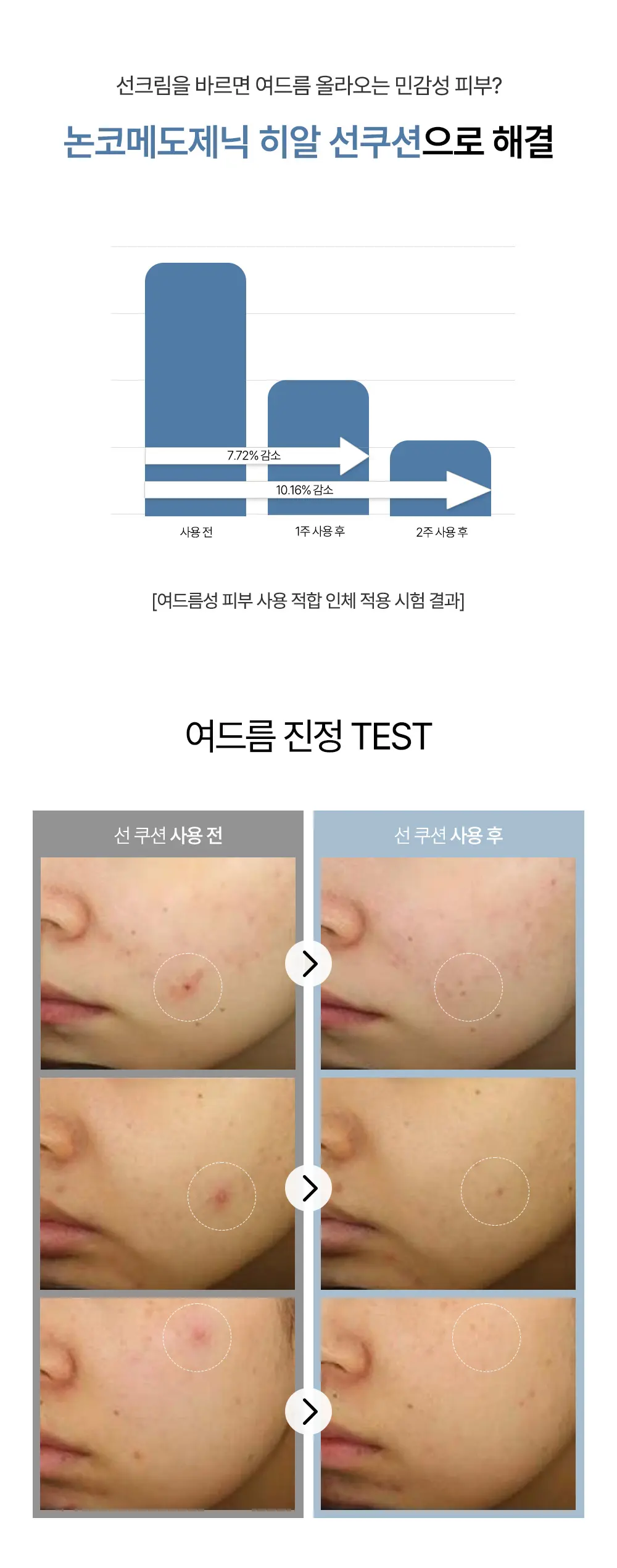 피톤 스쿠아 히알 블루 핑크 톤업 선 쿠션 (본품) Detail