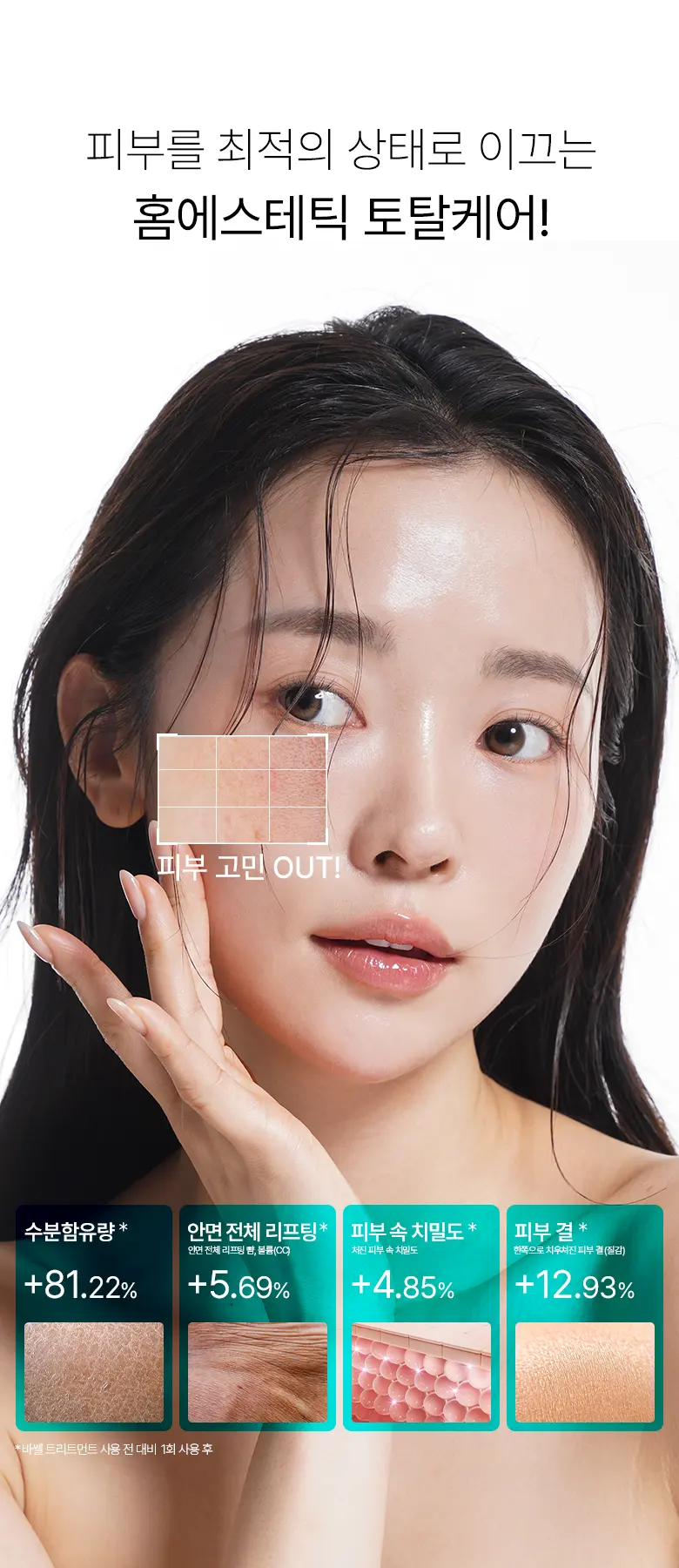 씨아클라 르제 바쎌 퍼스널 Detail