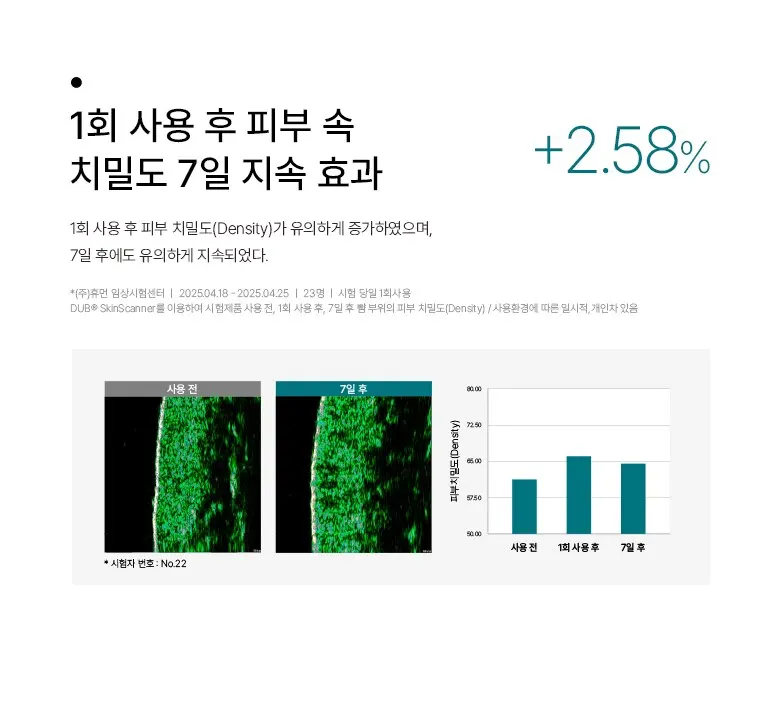 씨아클라 르제 바쎌 퍼스널 Detail