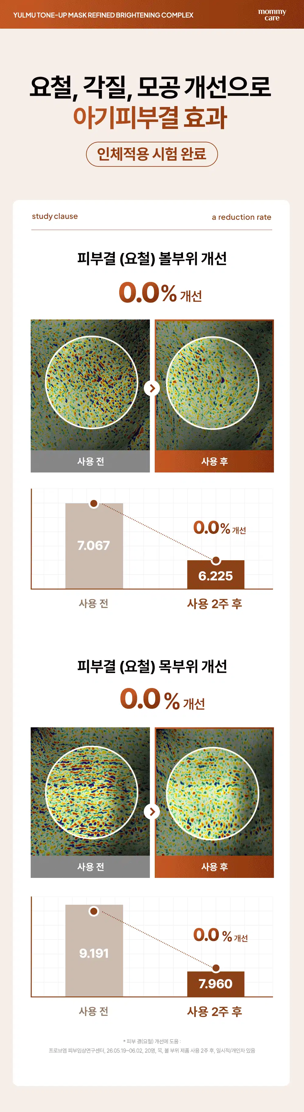 율무 TXA 브라이트닝 워시오프 마스크 120g Detail