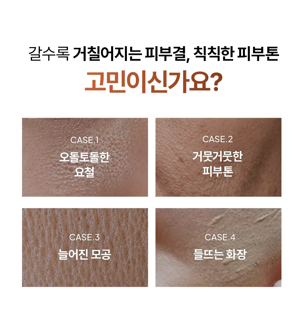 율무 TXA 브라이트닝 워시오프 마스크 120g Detail