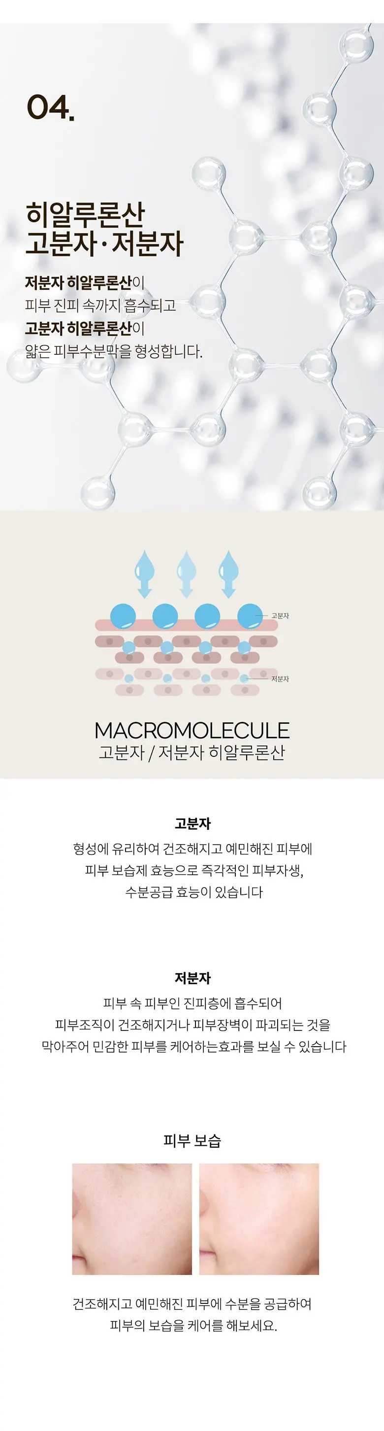 프랑스와즈 고분자 히알루론산 원액, 100ml, 1개 Detail