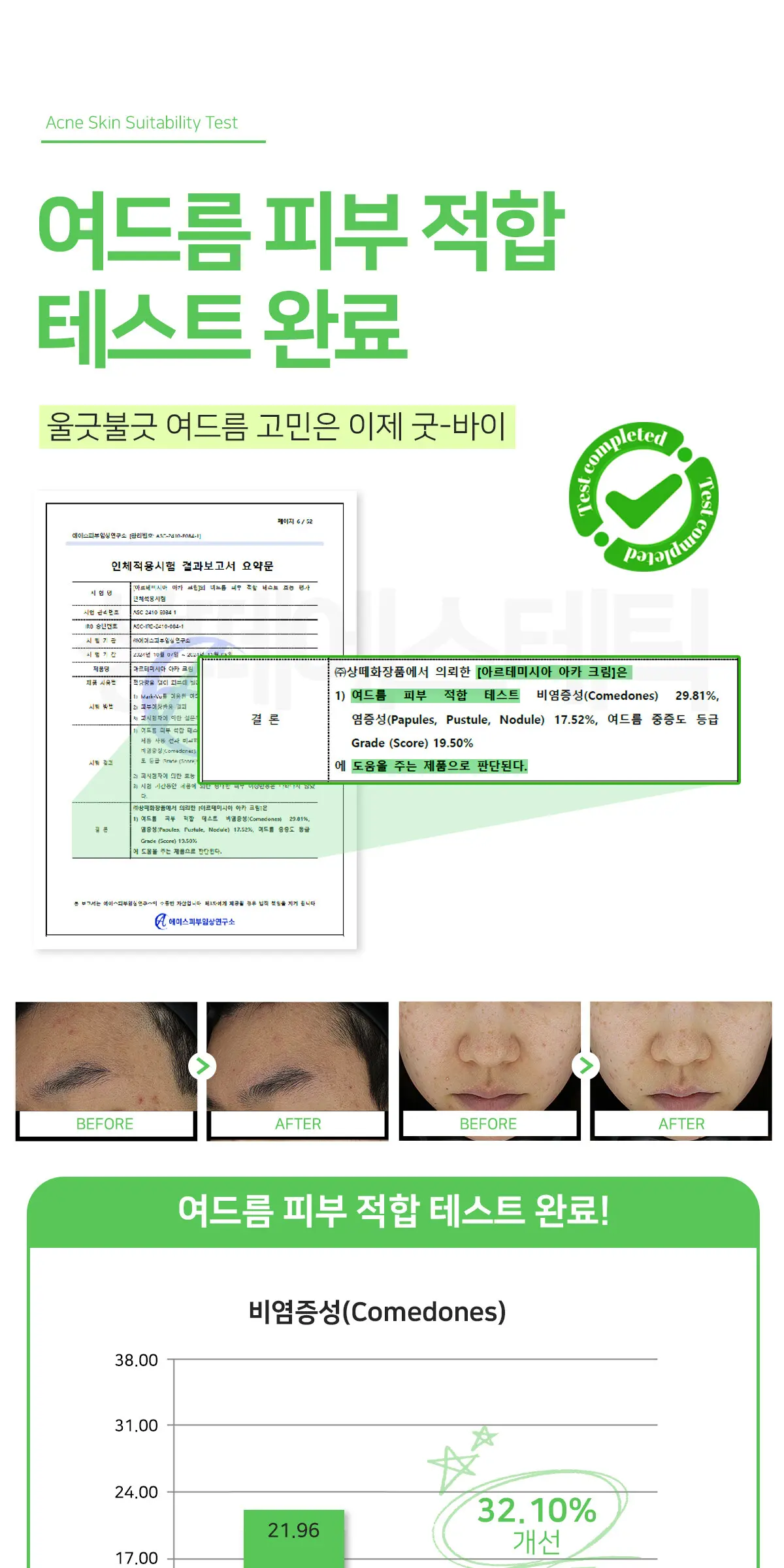 아르테미시아 아카 크림 150g Detail