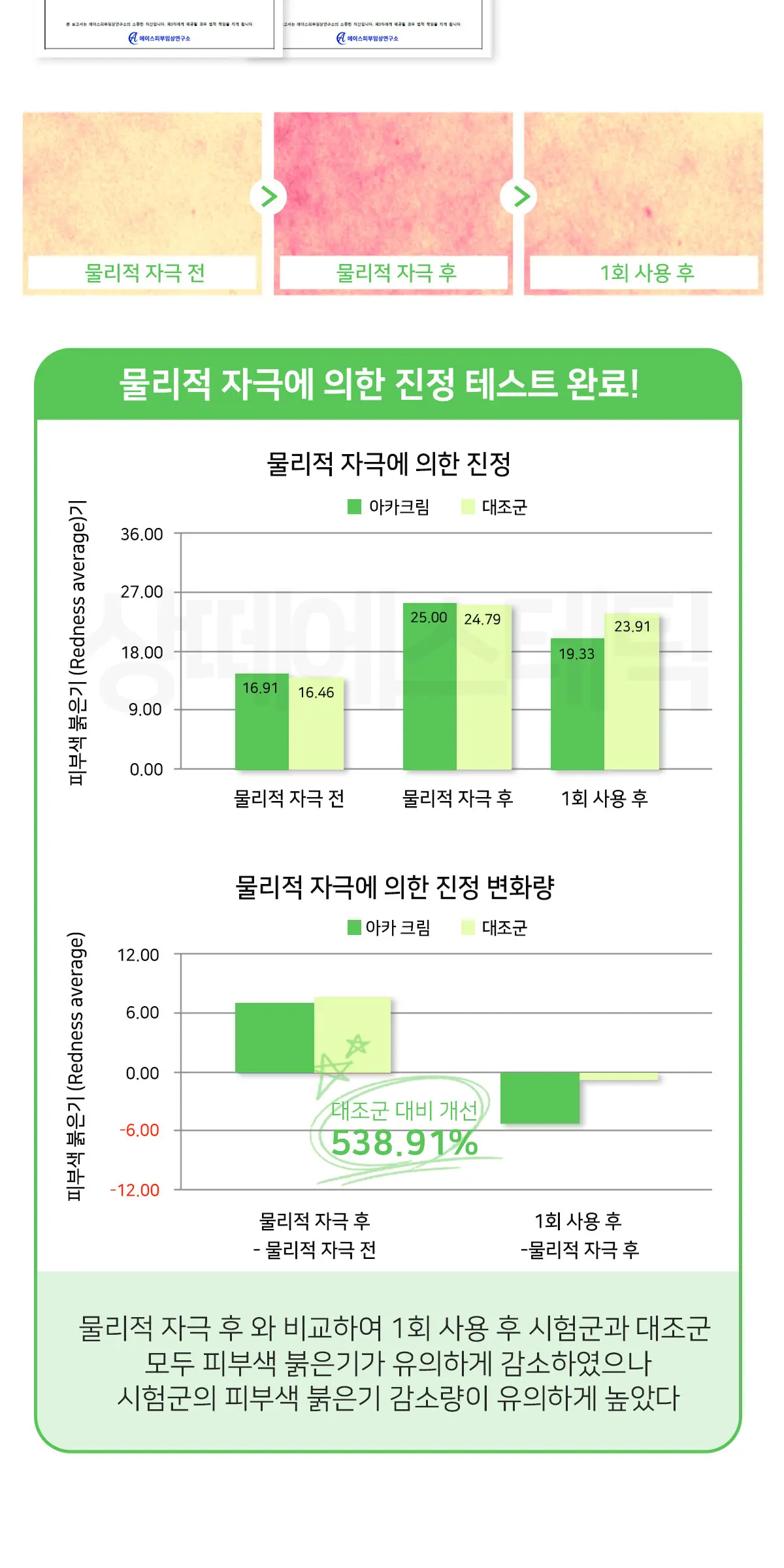 아르테미시아 아카 크림 150g Detail