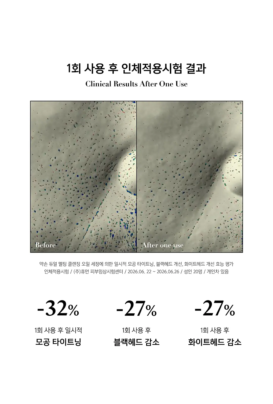 약손명가 듀얼 멜팅 클렌징 오일 150ml Detail