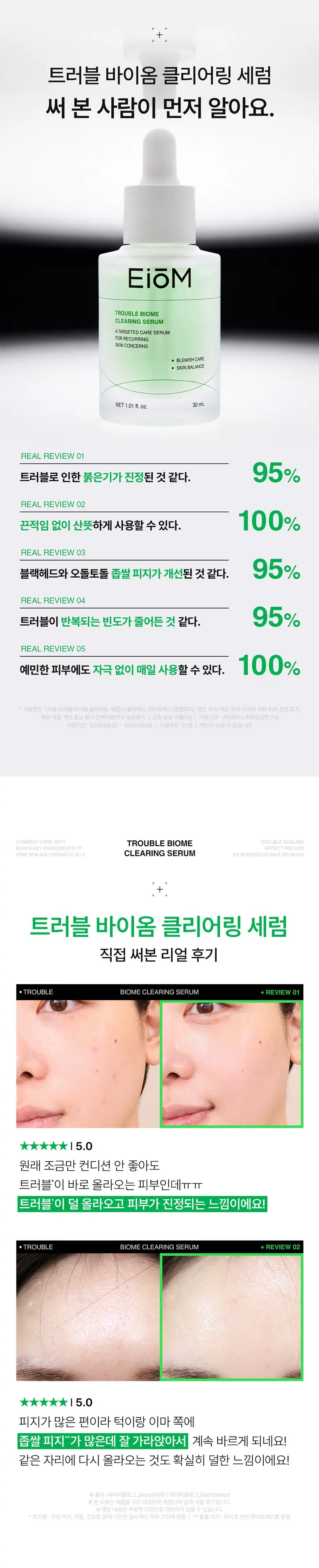 [좁쌀고민해결] 이옴 트러블 바이옴 클리어링 세럼, 1개, 30ml Detail