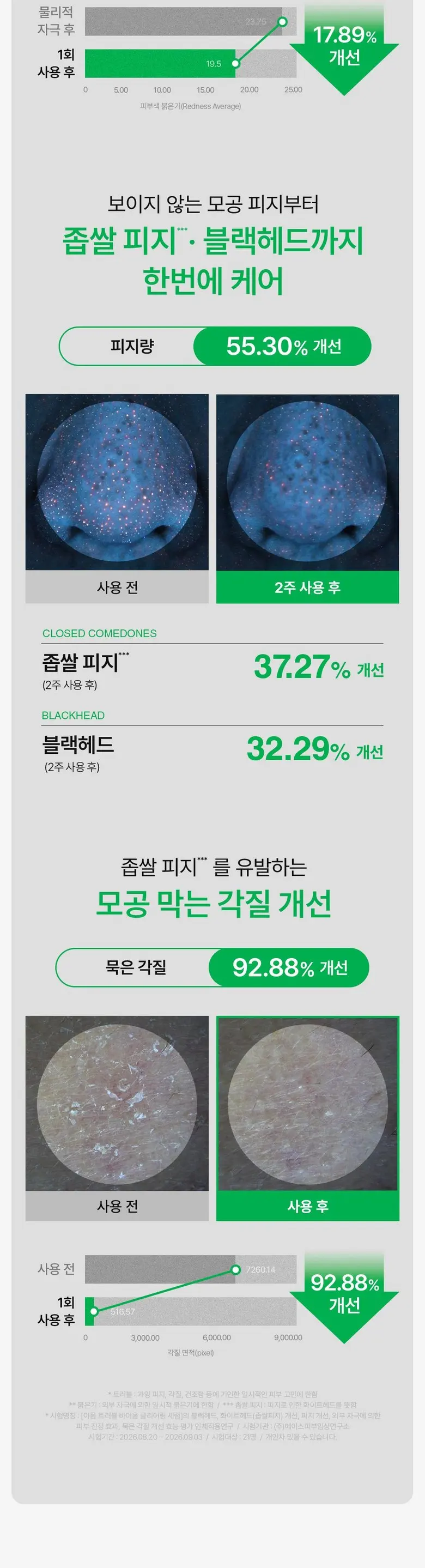 [좁쌀고민해결] 이옴 트러블 바이옴 클리어링 세럼, 1개, 30ml Detail