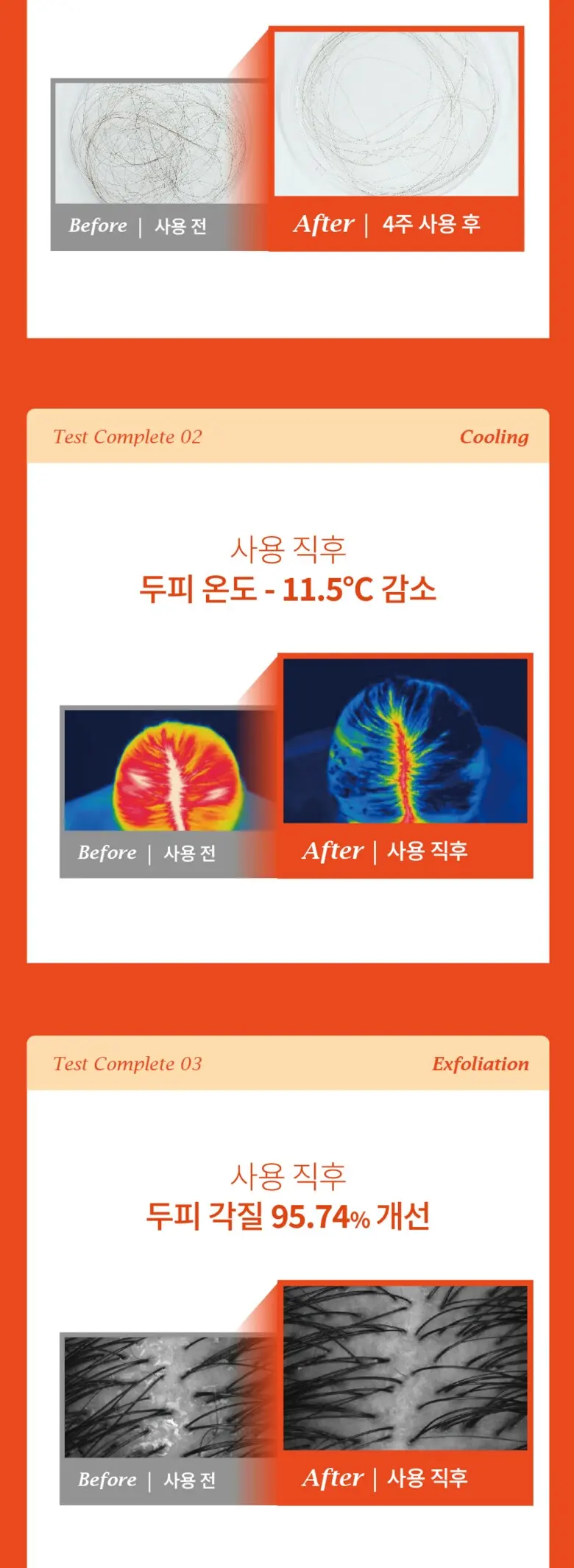 바인그로우 엑소샷 두피 탈모 앰플, 2개, 120ml Detail