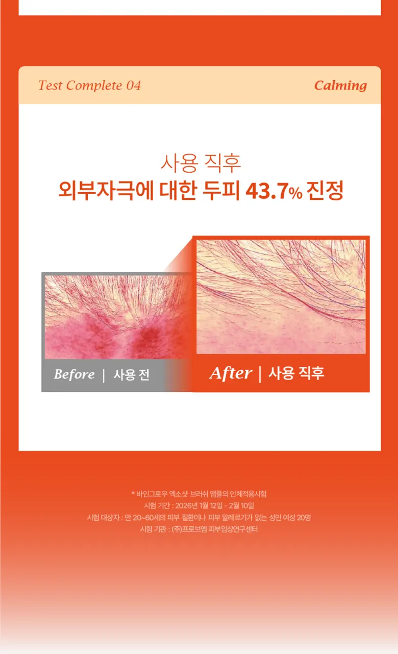 바인그로우 엑소샷 두피 탈모 앰플, 2개, 120ml Detail