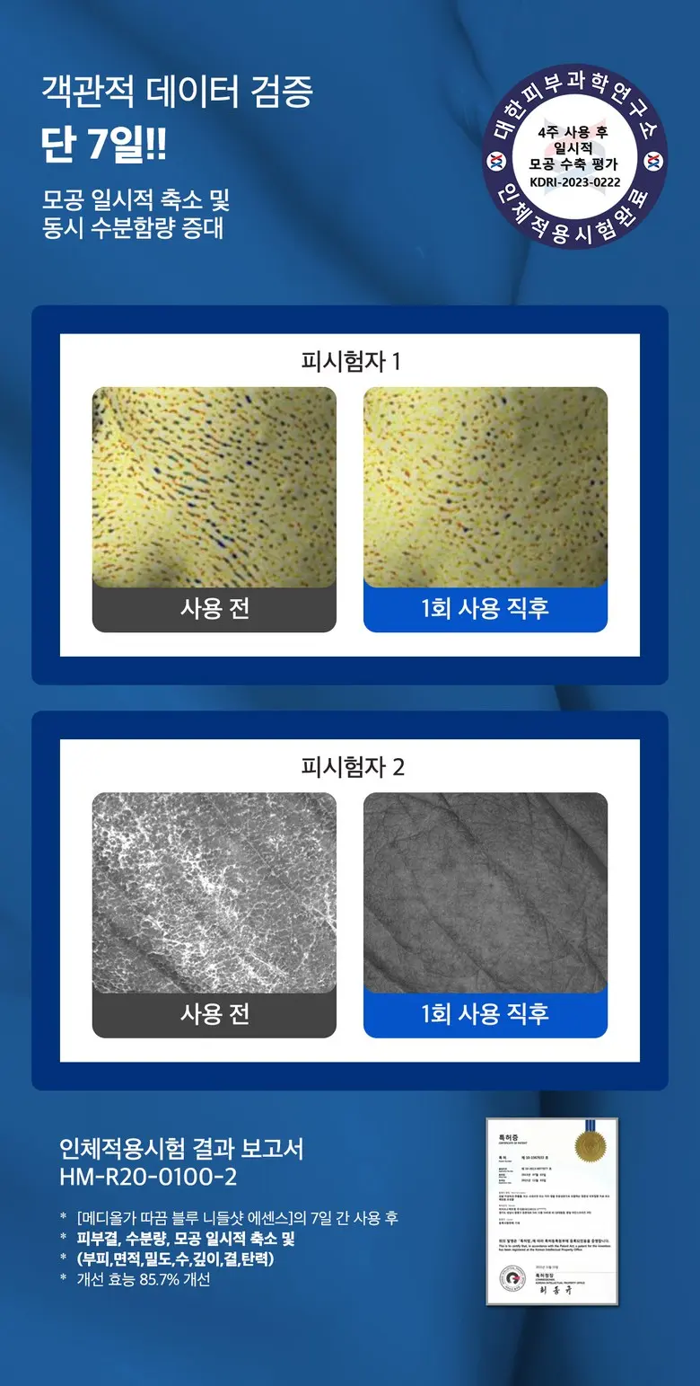메디올가 따끔 블루 스피큘 3000ppm 피부결 모공케어 턴오버 에센스, 1개, 30ml Detail