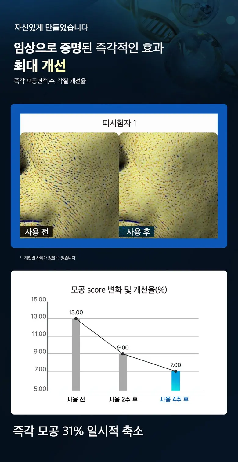 메디올가 따끔 블루 스피큘 3000ppm 피부결 모공케어 턴오버 에센스, 1개, 30ml Detail