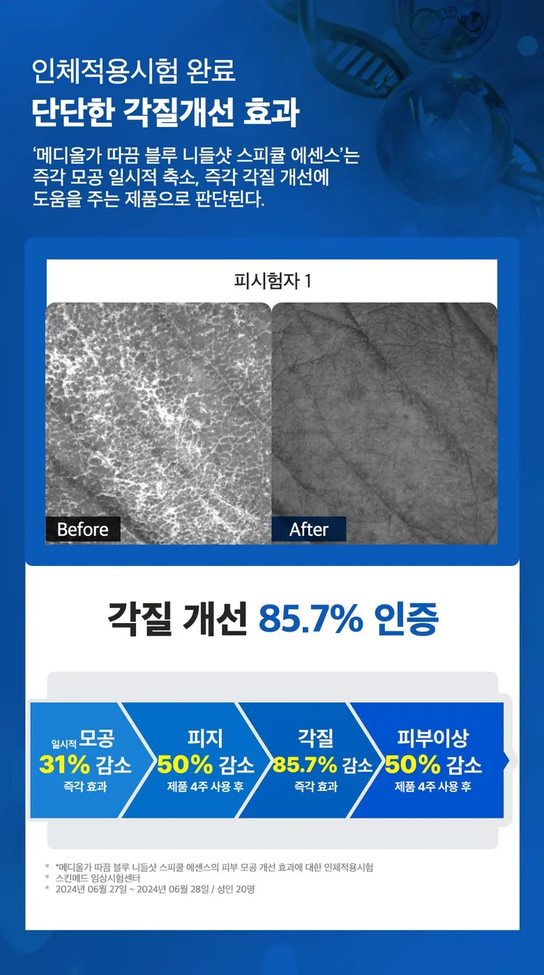 메디올가 따끔 블루 스피큘 3000ppm 피부결 모공케어 턴오버 에센스, 1개, 30ml Detail
