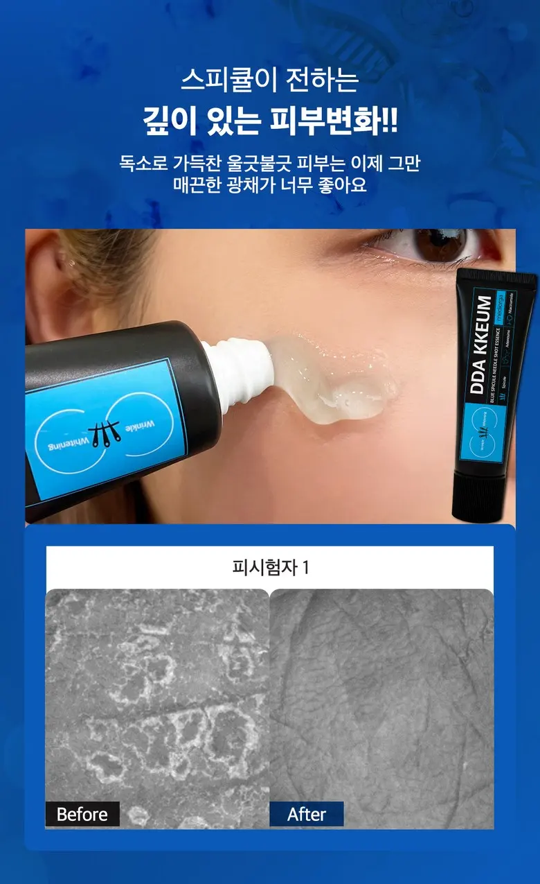 메디올가 따끔 블루 스피큘 3000ppm 피부결 모공케어 턴오버 에센스, 1개, 30ml Detail