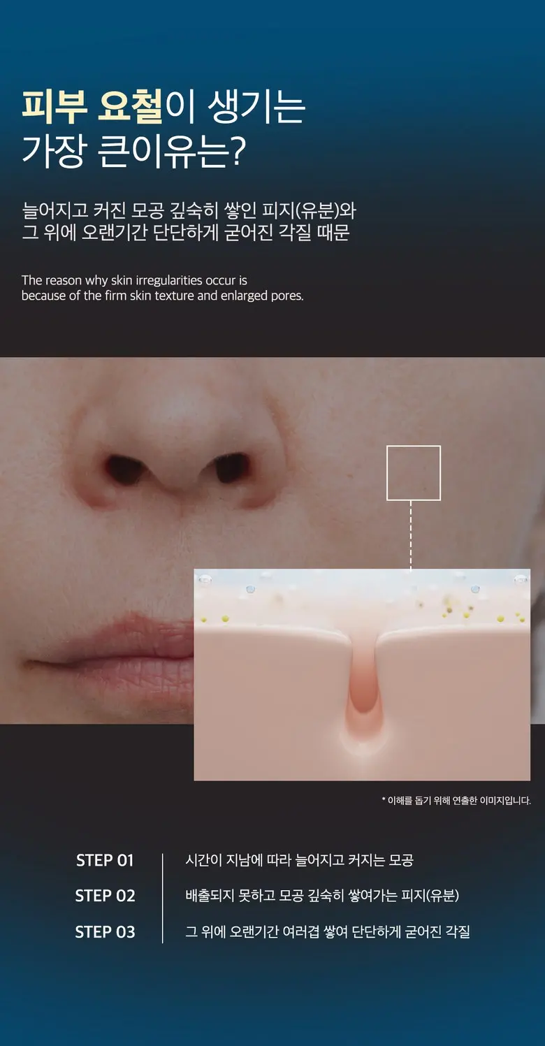 메디올가 따끔 블루 스피큘 3000ppm 피부결 모공케어 턴오버 에센스, 1개, 30ml Detail