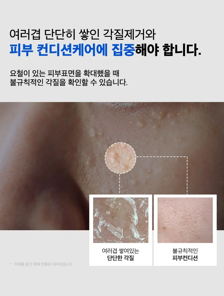 메디올가 따끔 블루 스피큘 3000ppm 피부결 모공케어 턴오버 에센스, 1개, 30ml Detail