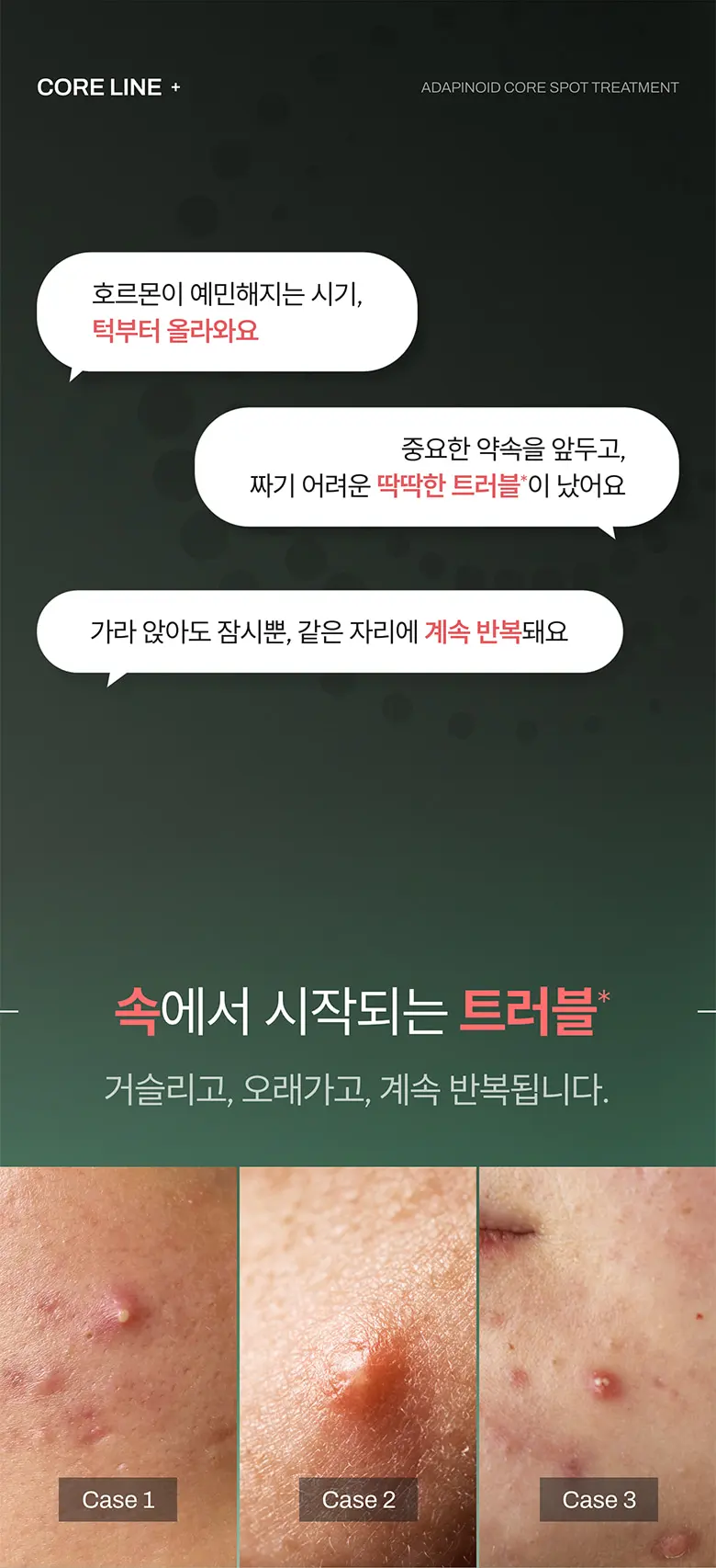 아다피노이드 코어 스팟 트리트먼트 30ml Detail