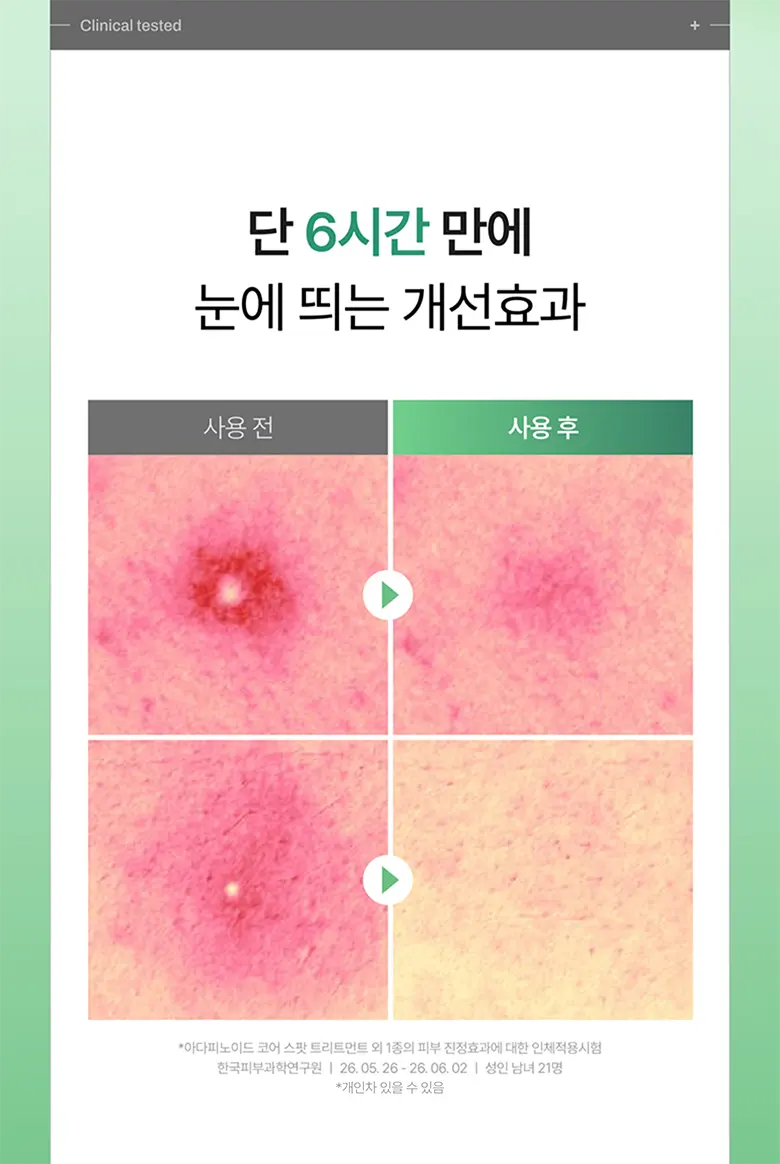 아다피노이드 코어 스팟 트리트먼트 30ml Detail