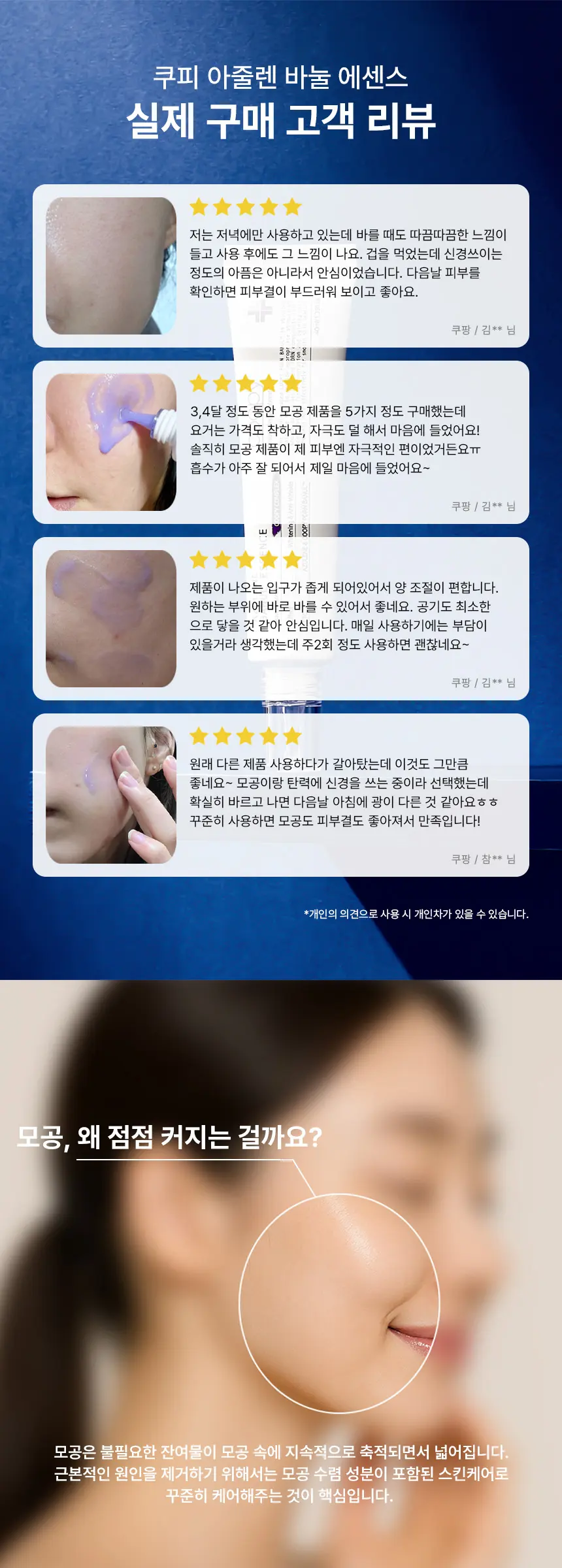 모공 피부결 66% 개선 아줄렌 바눌에센스 니들 600샷 40ml Detail