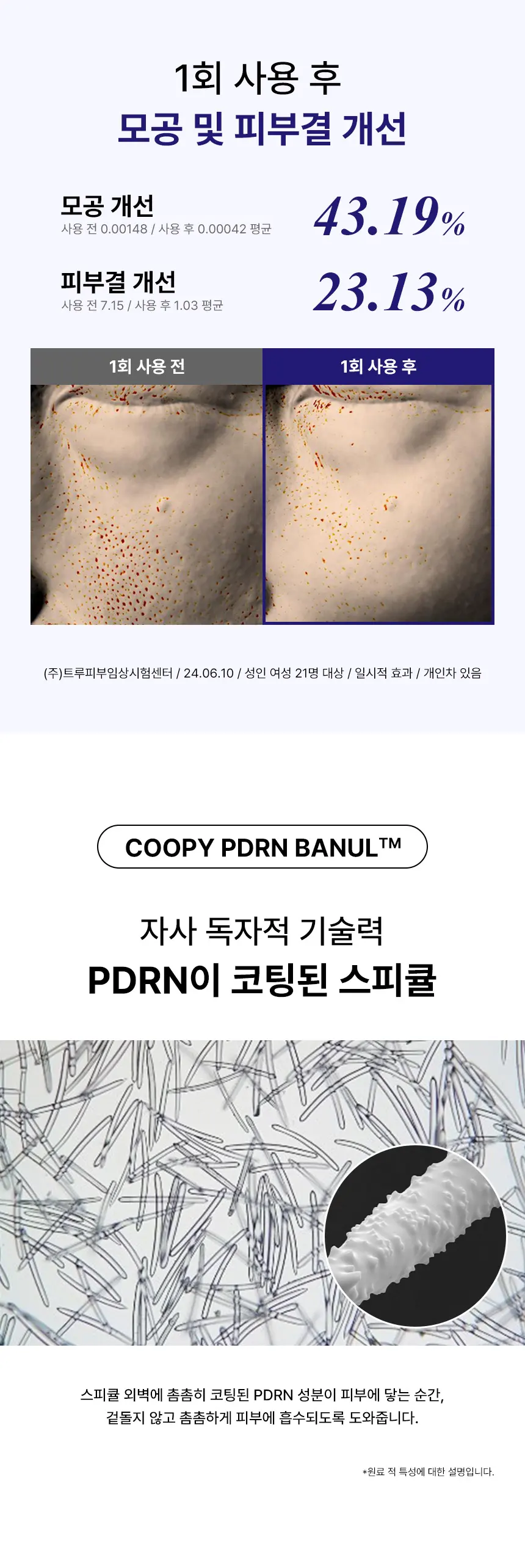 모공 피부결 66% 개선 아줄렌 바눌에센스 니들 600샷 40ml Detail