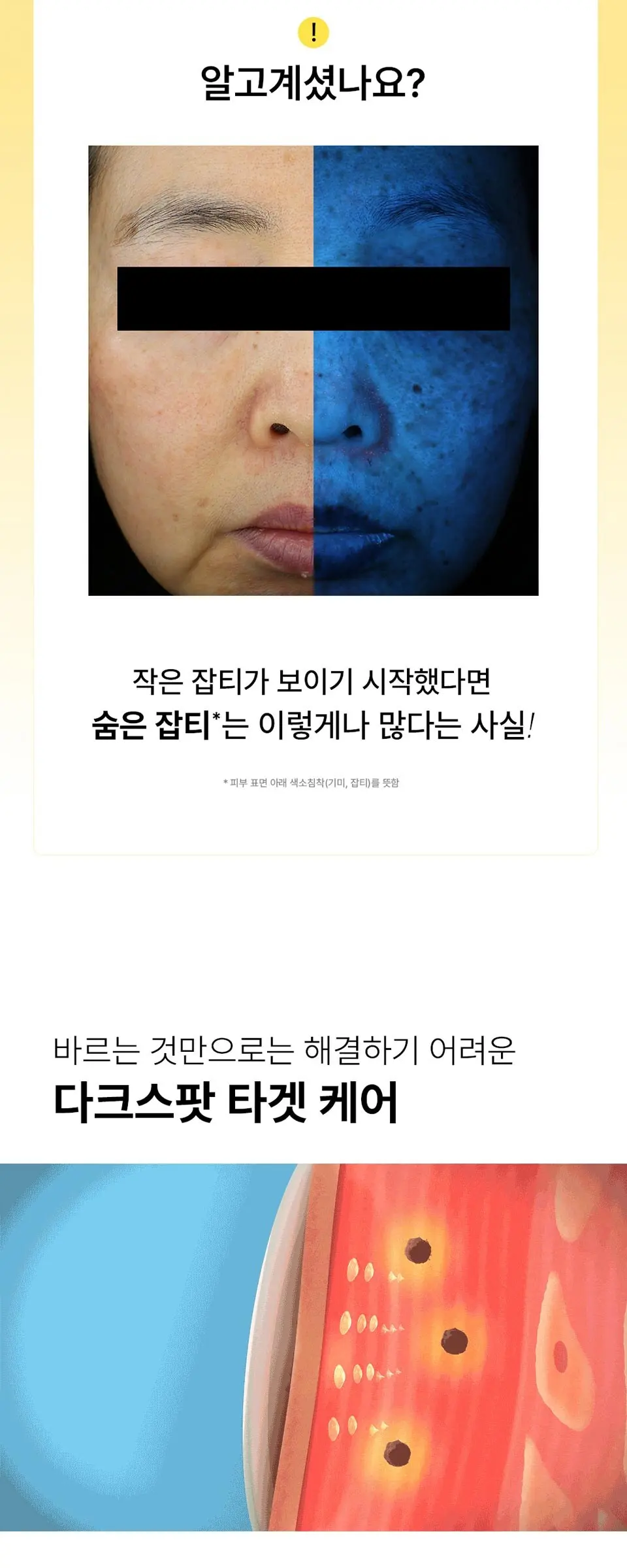 다크스팟케어 마이크로콘 패치 6패치 Detail