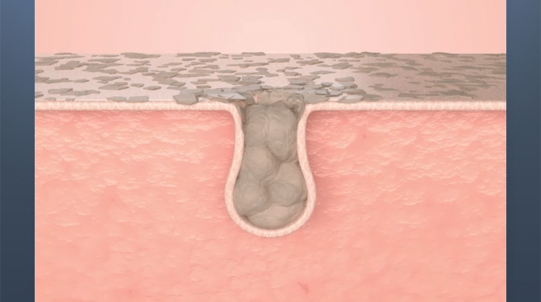 아하 바하 롱롱 패드 80 pads Detail