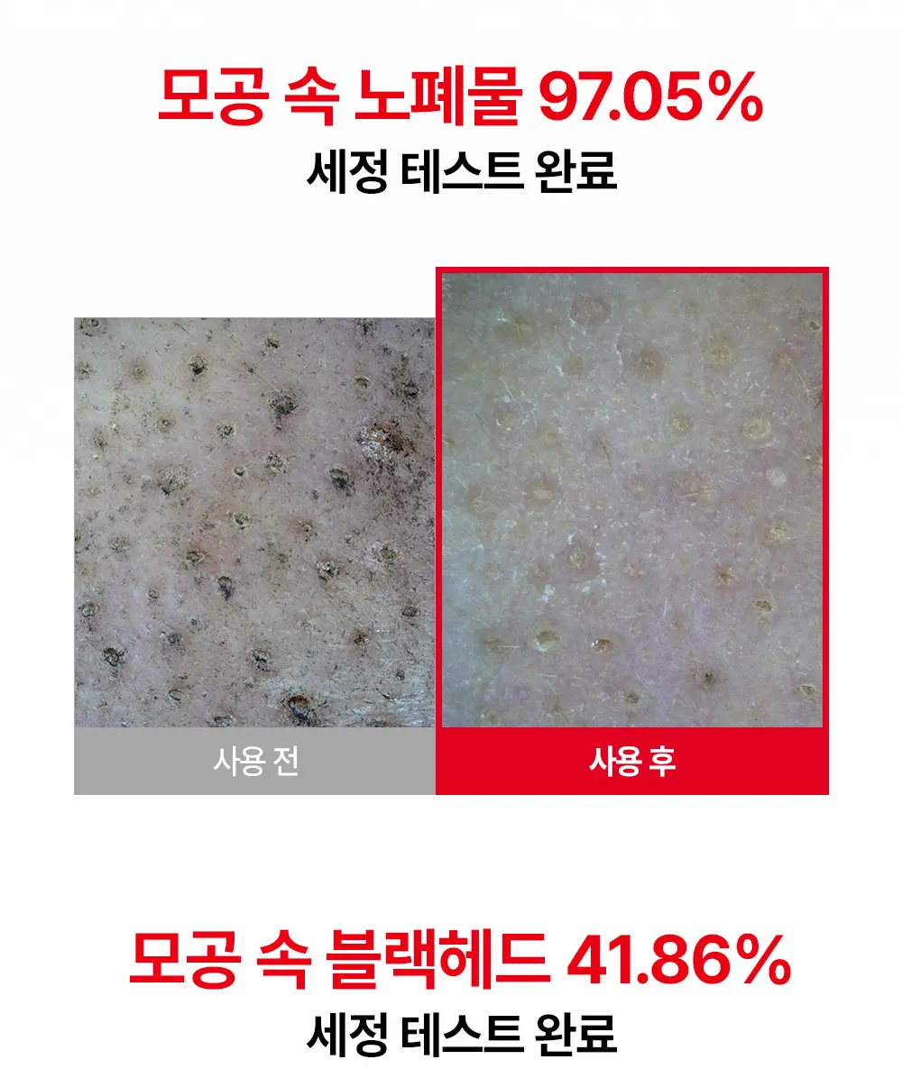 NEW 딥 클린 클레이 모공 클렌징폼 150ml Detail