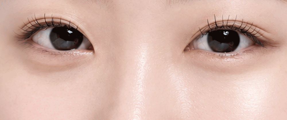 PDRN 핑크 비타민 글로우 부스팅 아이세럼 10ml Detail