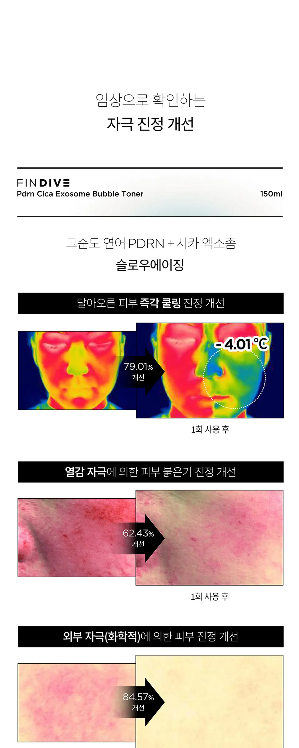 PDRN 시카 엑소좀 버블 토너 150ml Detail