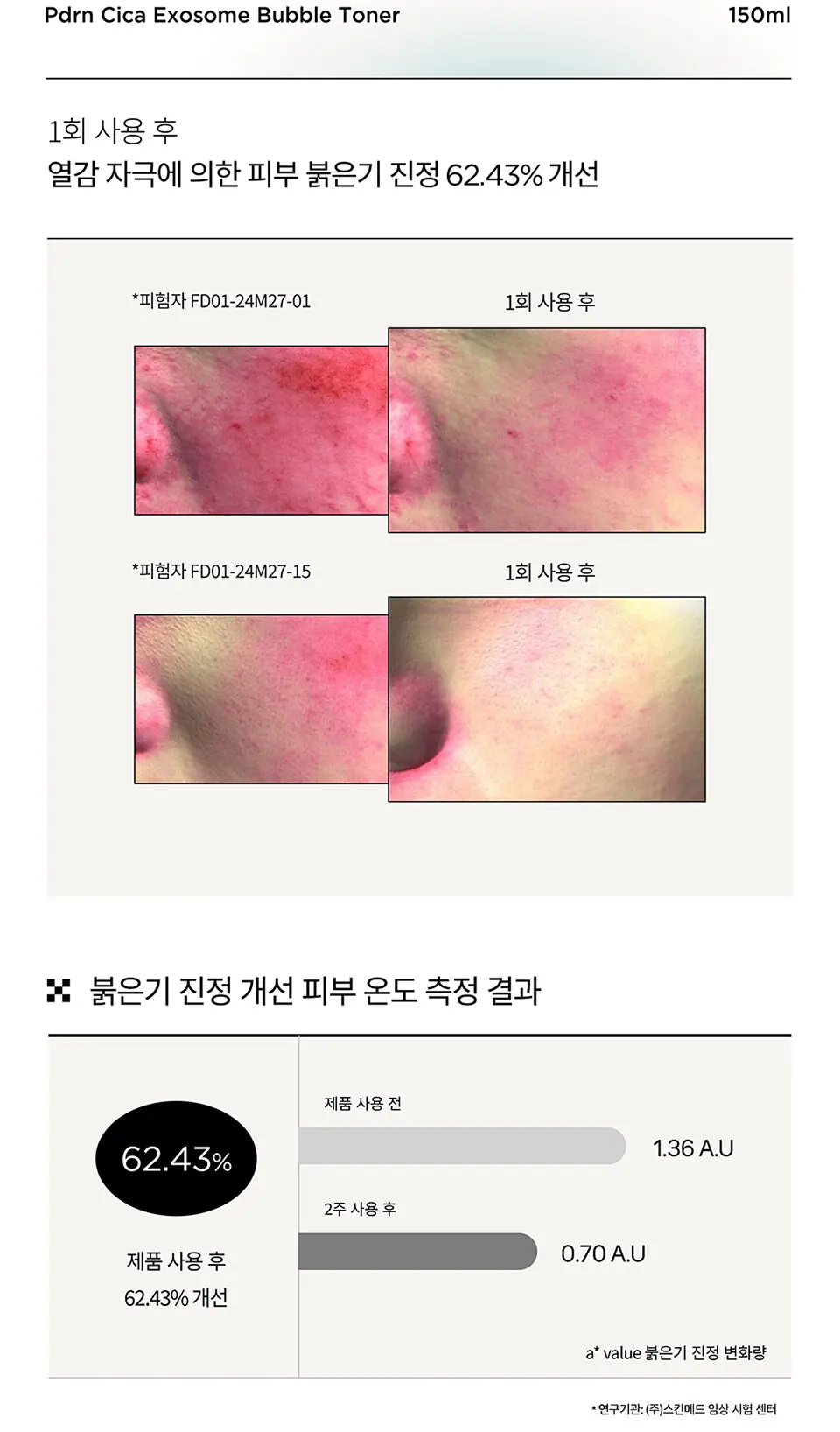 PDRN 시카 엑소좀 버블 토너 150ml Detail