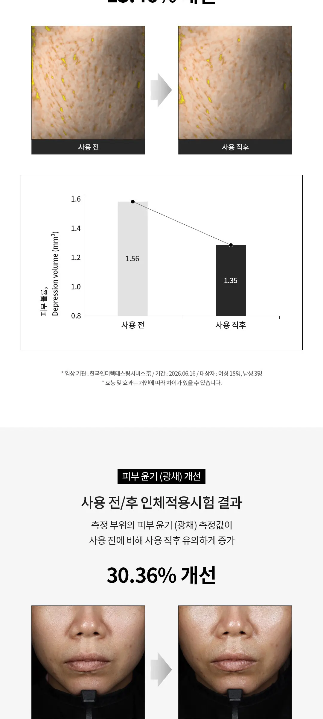 닥터리엔장 PDRN 리쥬브 세럼 15ml Detail