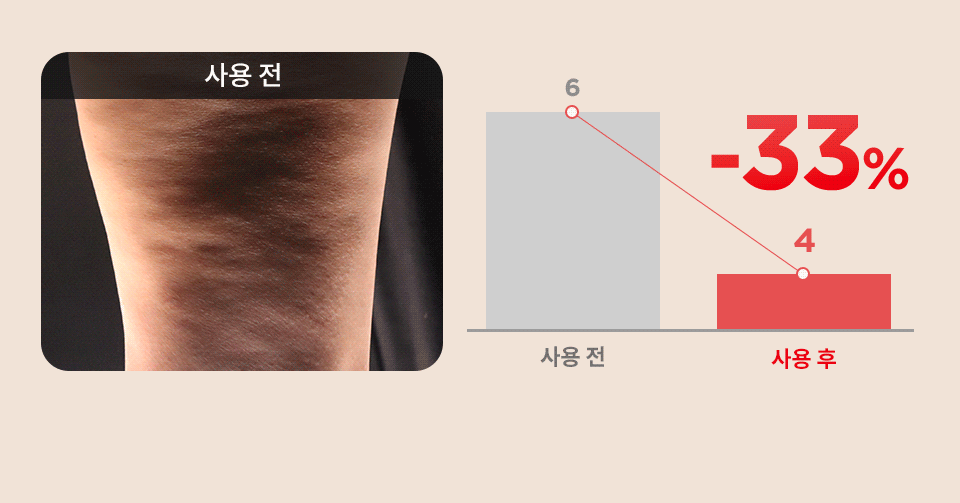 [콜마PICK/셀룰라이트 개선]아녹 위고슬림핏 아디포닌 펩타이드 괄사 슬리밍 바디로션 120ml | 올리브영 Detail